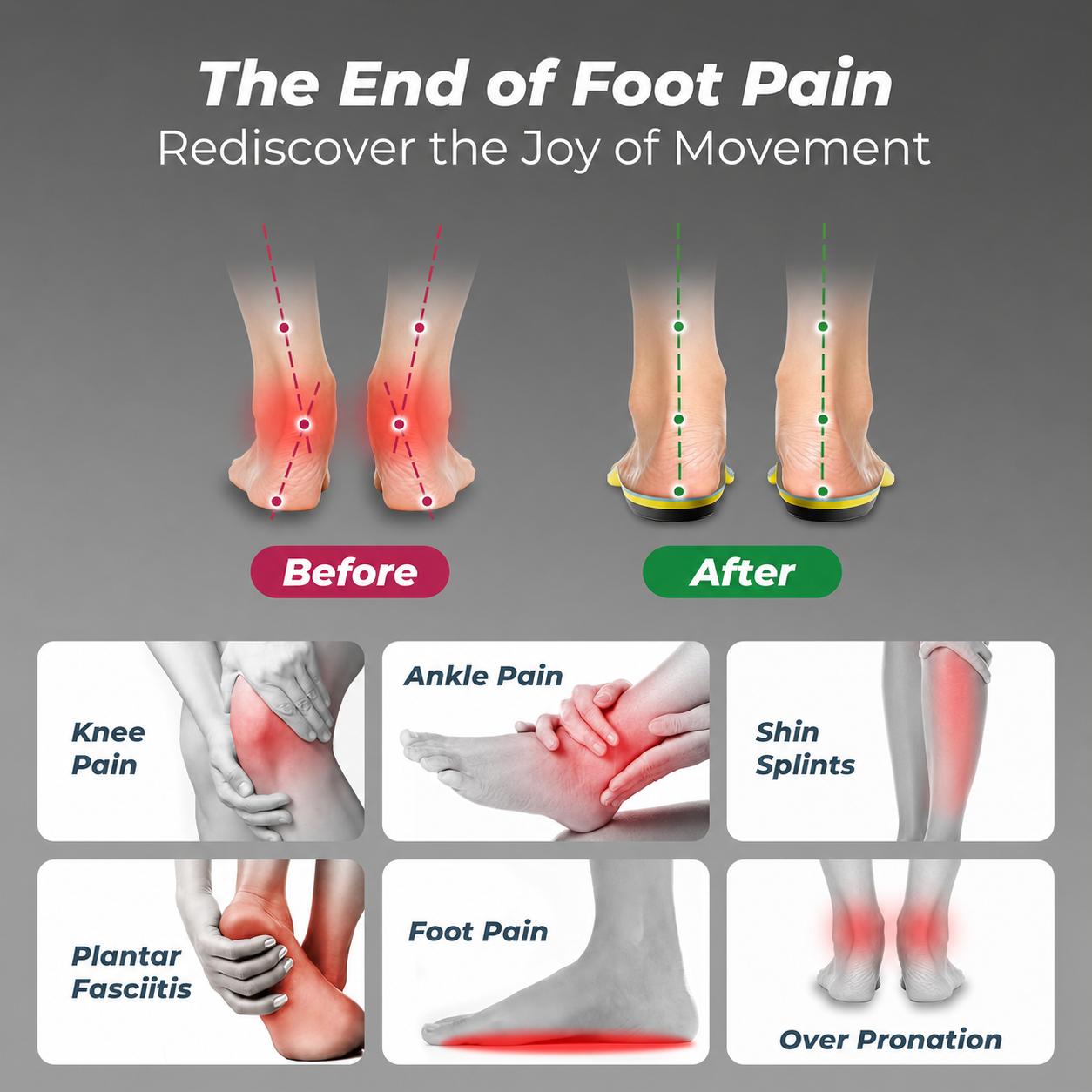 WALKHERO® Premium Arch Support Pain Relief Insoles - Buy 1 Get 1 Free